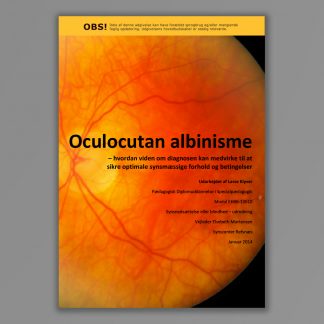 Forside af publikationen: Oculocutan albinisme